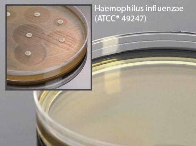Hardy Diagnostics - H07 Haemophilus Test Medium Agar 15 X 150 mm For Susceptibility Testing
