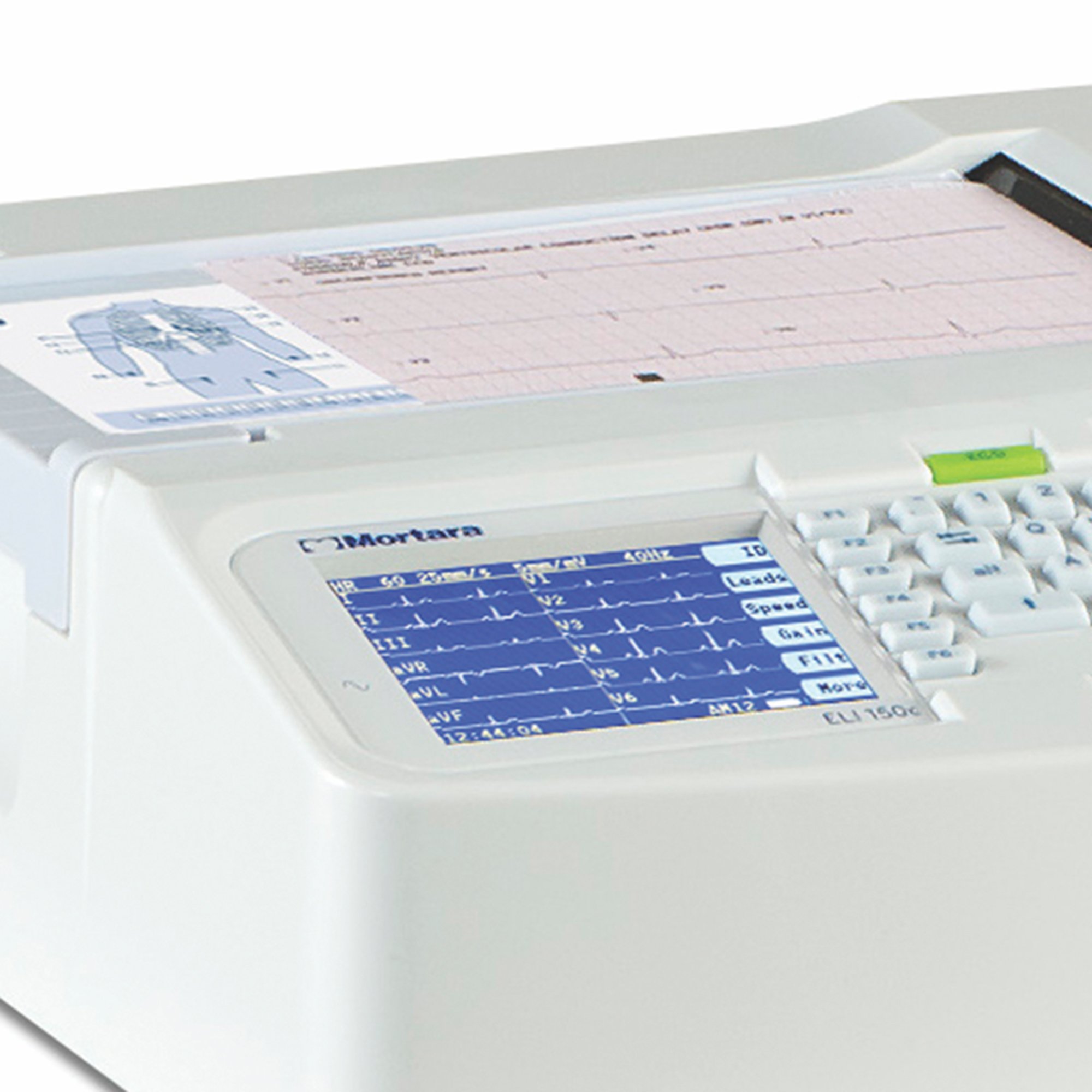 McKesson Brand - MLBUR150C-C1X McKesson LUMEON™ and Burdick Resting ECG Machine