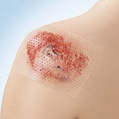 Cuticell Contact Wound Contact Layer Dressing 7268001 by BSN Medical