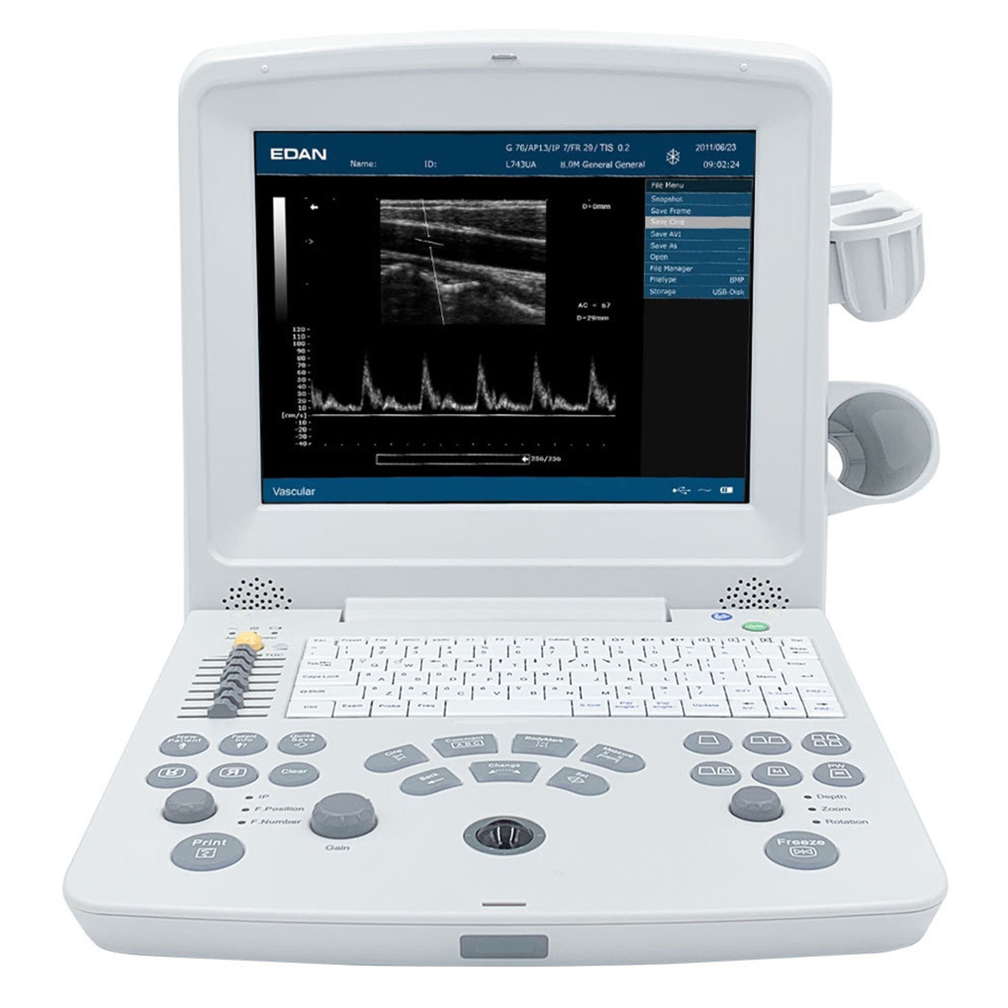 EdanUSA & MDPro - DUS60_MAINUNIT Ultrasound System DUS 60