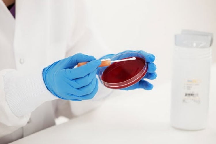 Microbiologics Inc - 5192P Microbial Identification Control Set KWIK-STIK™ Vitek® 2 GN Comprehensive 2 Units