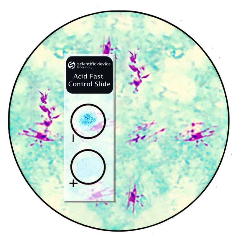 StatLab Medical Products - 351 Microbial Identification Control Set Acid Fast Stain Positive Level / Negative Level 10 Slides