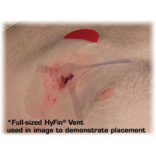 Hyfin Vent Compact Chest Wound Seal 10-0042 by North American Rescue