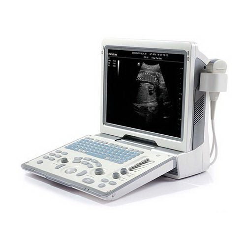 DP-50 Ultrasound System 1151E-PA00002 by Mindray USA