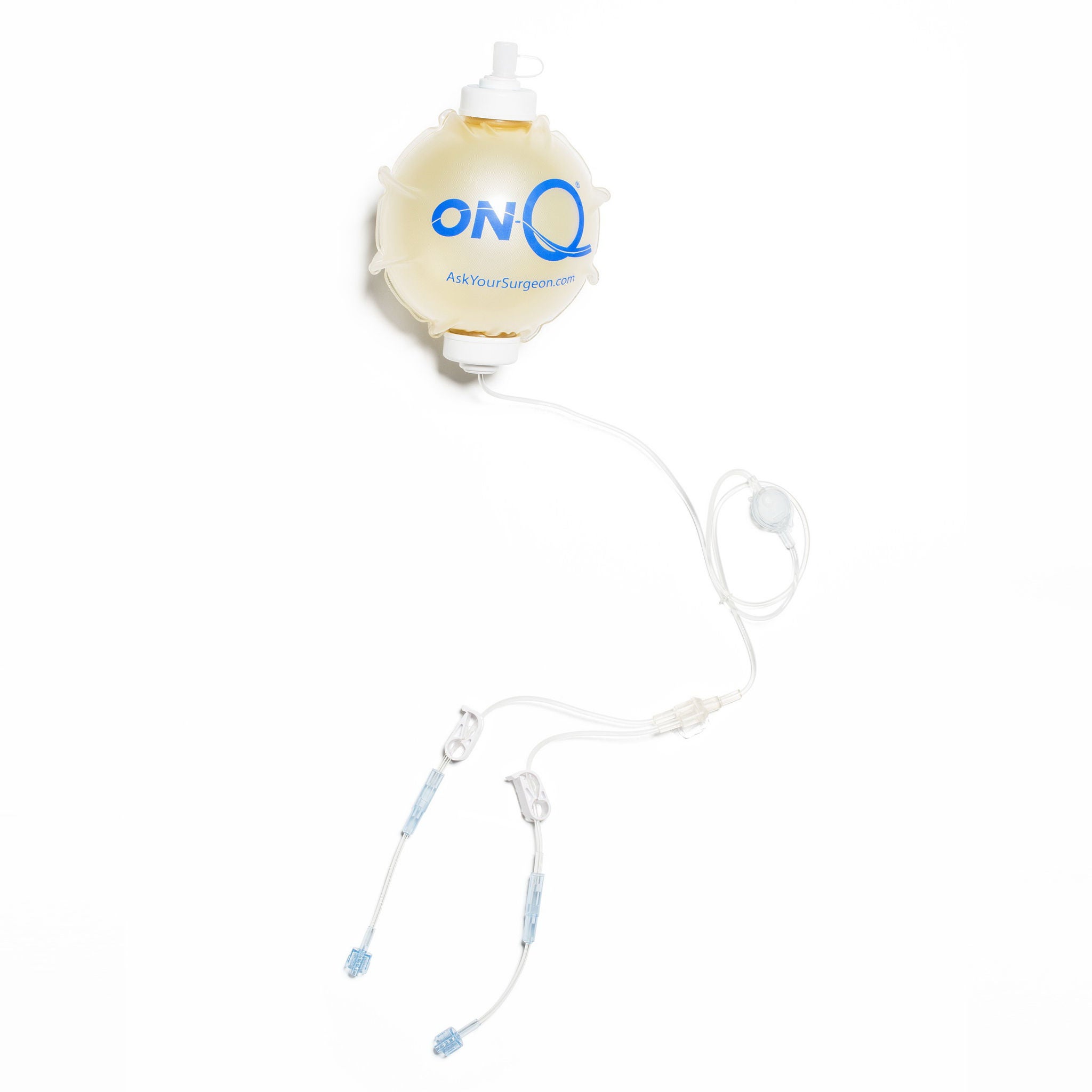 Avanos Medical Sales LLC - PM025-A Elastomeric Pump Kit with Catheter ON-Q* 270 mL Volume 4 mL / Hr. Flow Rate