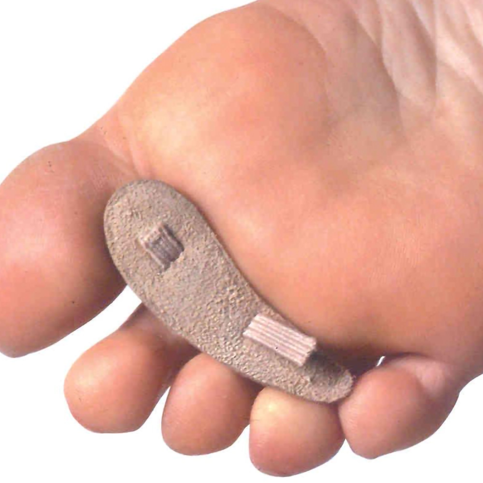 PediFix Hammer Toe Crest 8154A-XLL by Pedifix