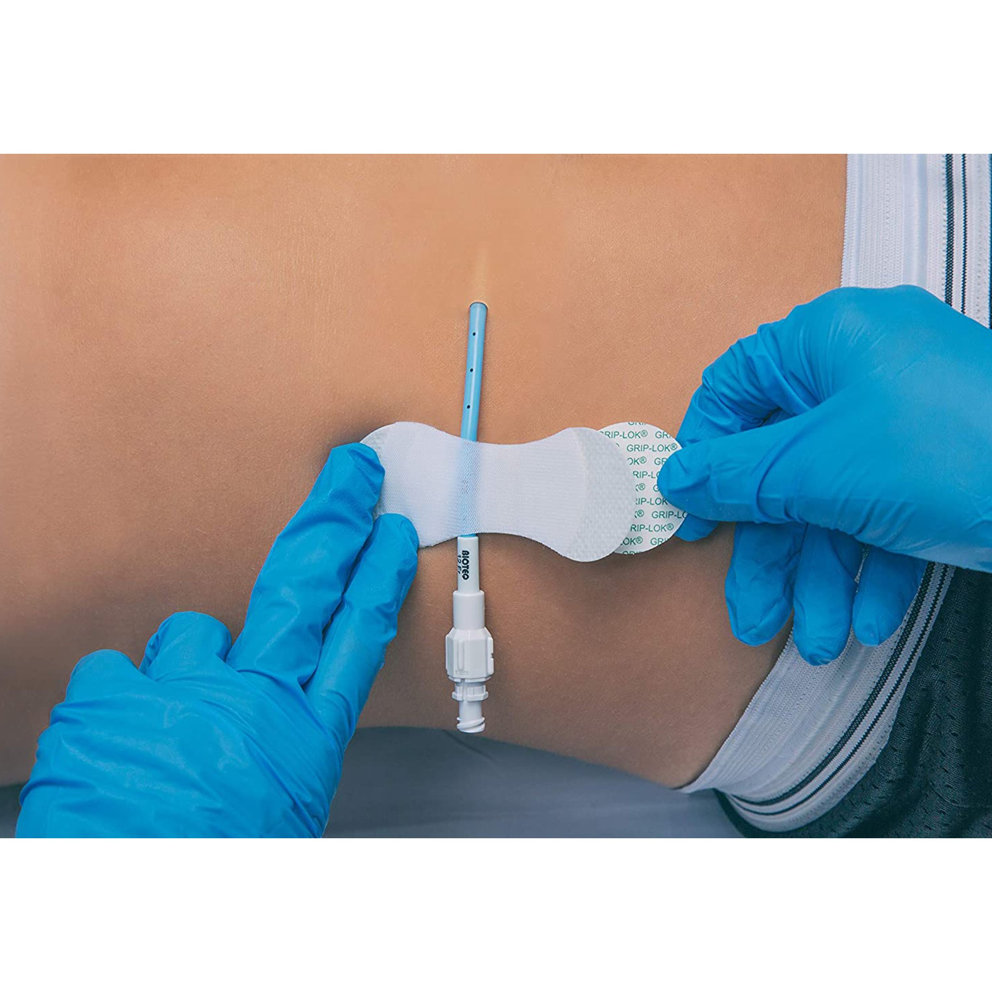 Tidi Products 3300MWA - Grip-Lok® Medium Wide Securement Device - 1/Each, 100/Box