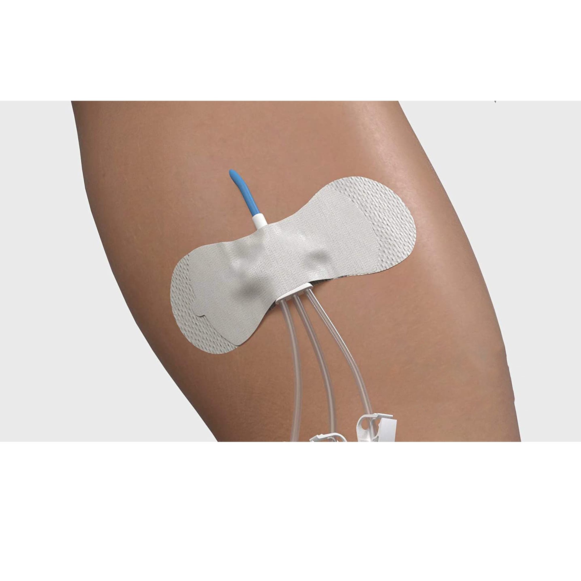 Tidi Products - 3300MWA Grip-Lok® Medium Wide Securement Device