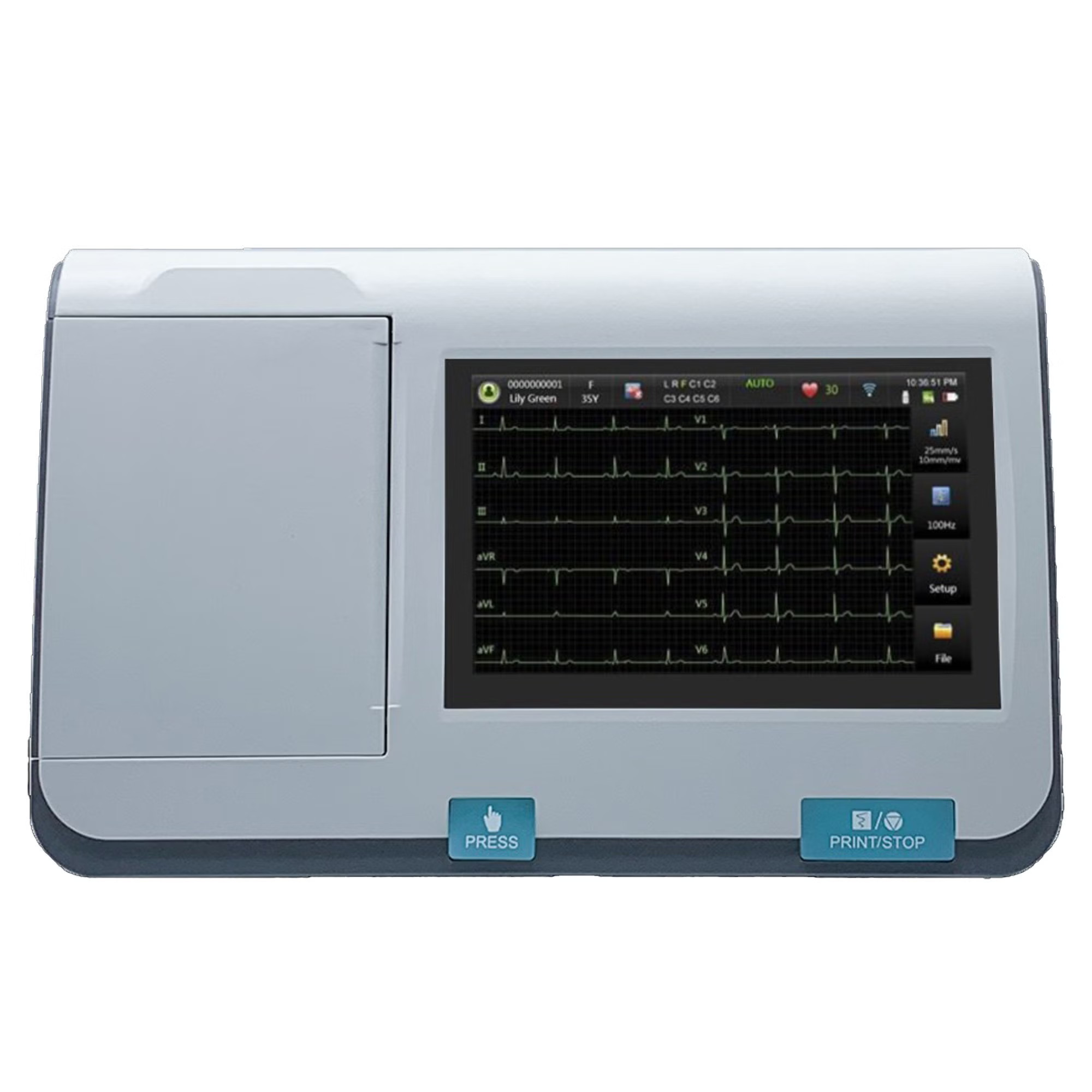 EdanUSA & MDPro - SE-301 Electrocardiograph Edan SE-301 AC Power / Battery Operated Touch Screen Display Resting