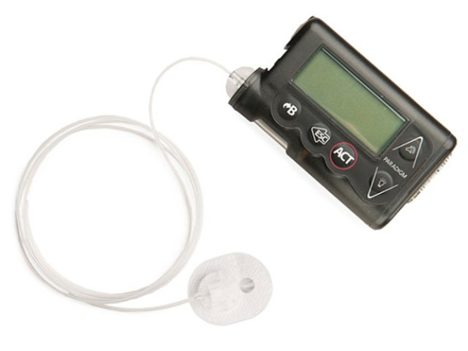 SilhouetteParadigm Insulin Infusion Set MMT-378A by Medtronic