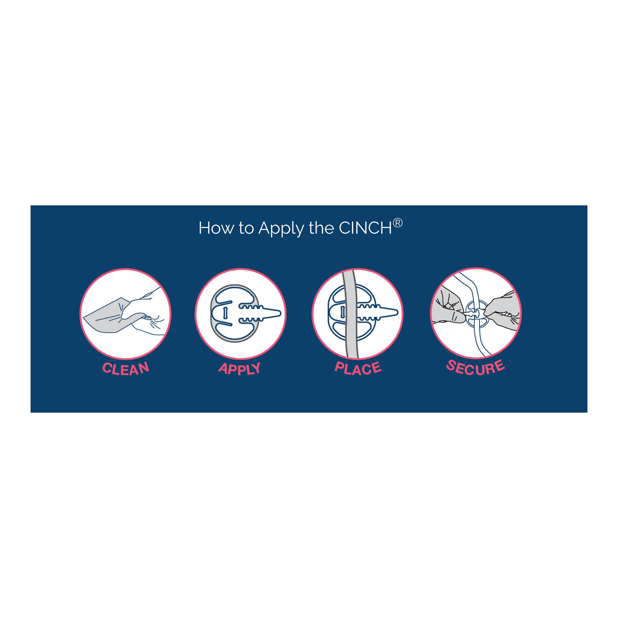Applied Medical Technology Inc - CINCH930L-10 Cinch® Tube Securement Device