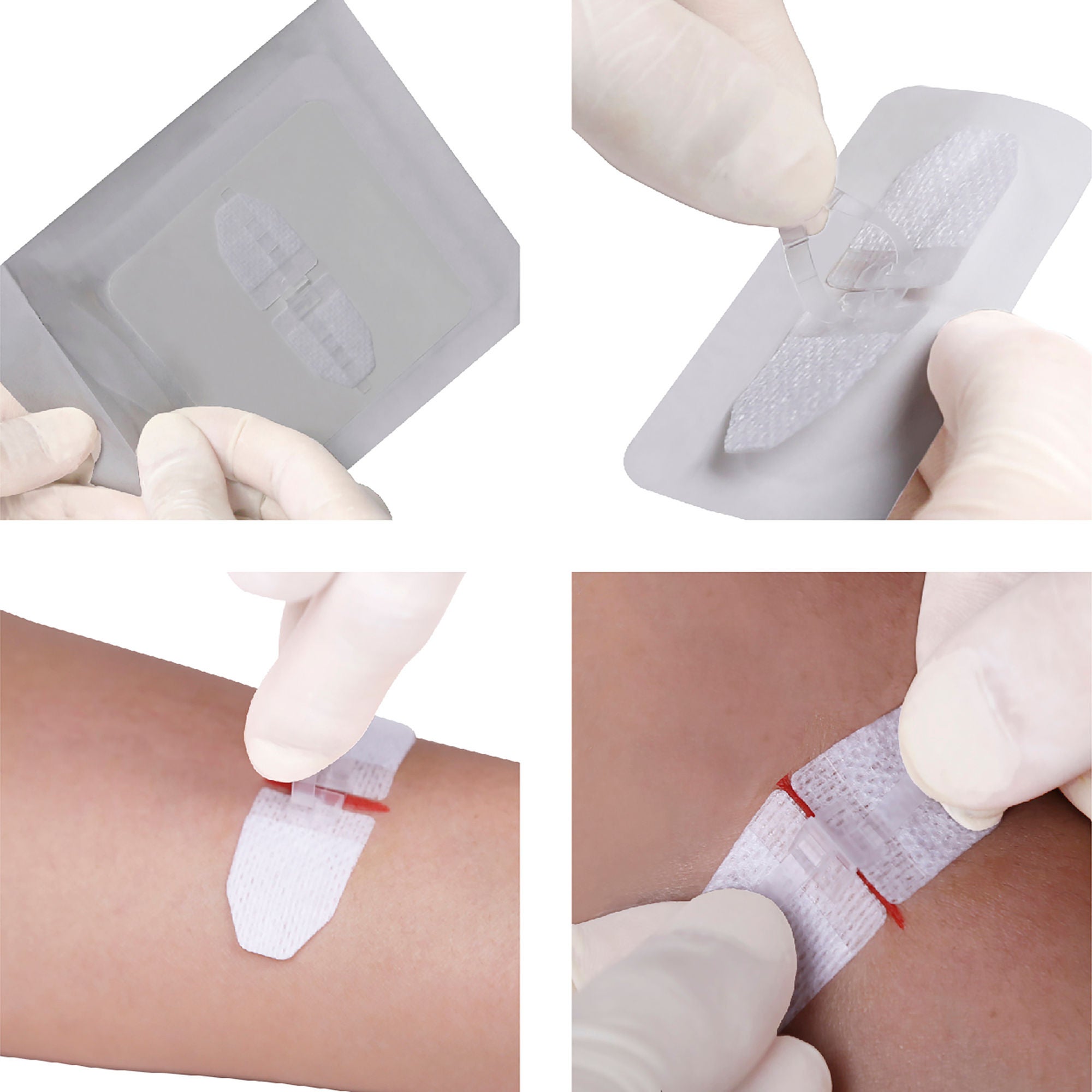 DermaClip US LLC - 62003 Non-Invasive Skin Closure DermaClip® 1 Inch X 21 mm Polypropylene Ventilated Strip Clear