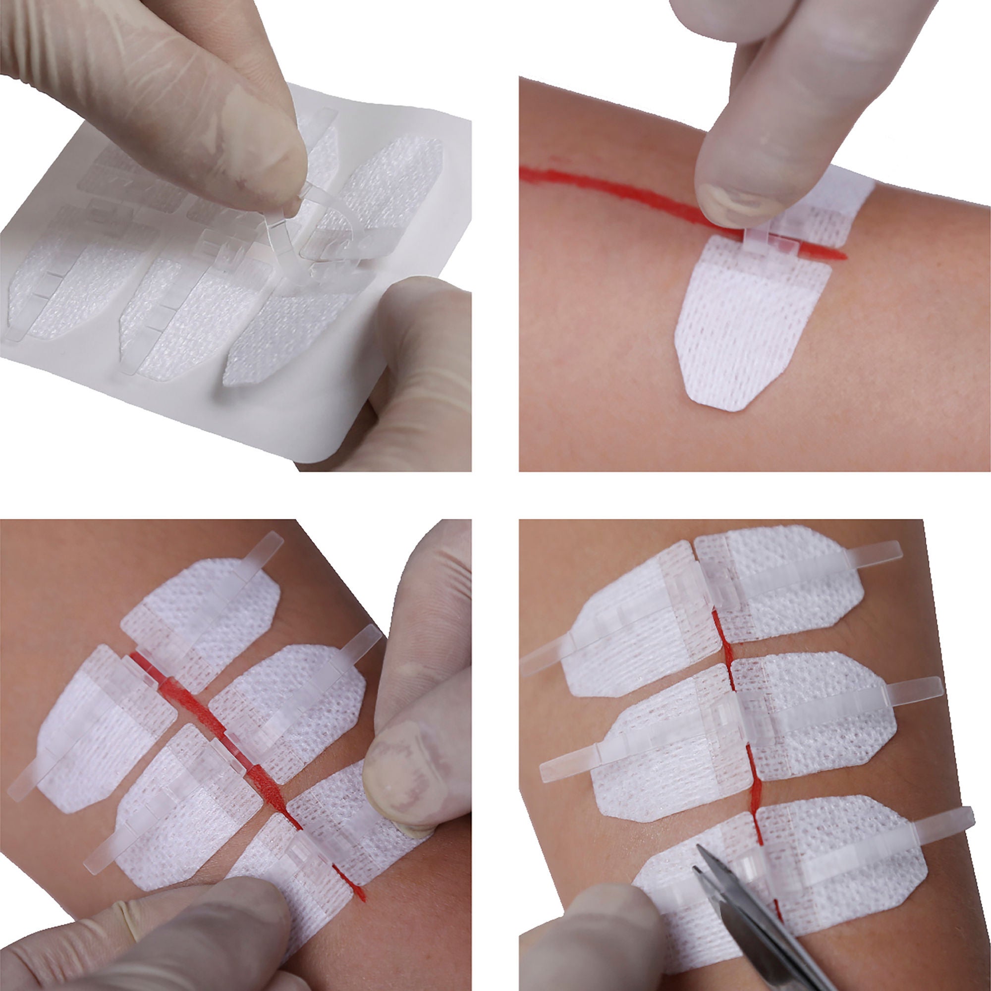 DermaClip US LLC - 62004 Non-Invasive Skin Closure DermaClip® 3 Inch X 21 mm Polypropylene Ventilated Strip Clear