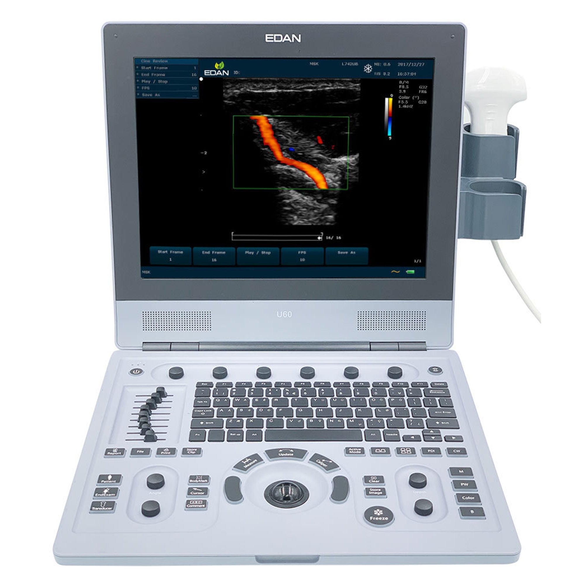 EdanUSA & MDPro - U60-D Ultrasound System EDAN U60