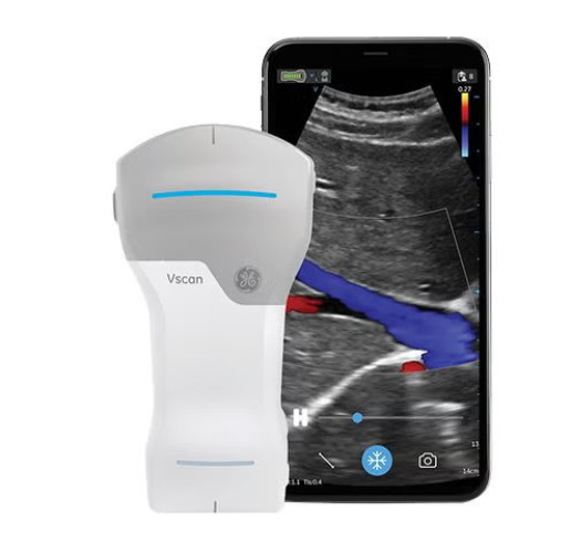 GE Healthcare - H8031CD Handheld Ultrasound System Vscan Air™