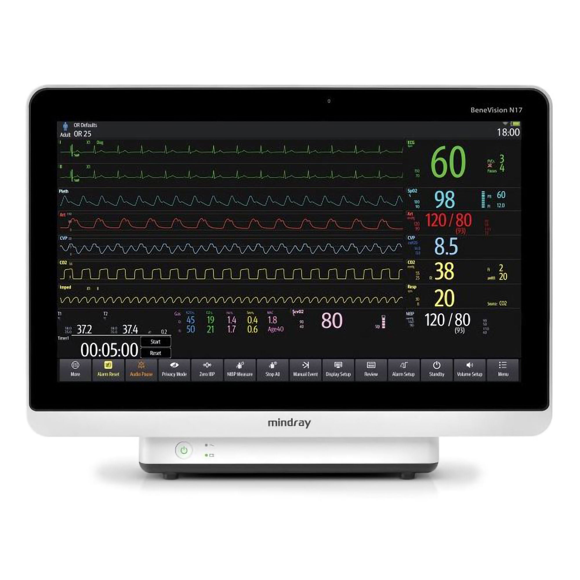 Mindray USA - 121-001522-00 Patient Monitor BeneVision™ N12 Monitoring 3/5 6 Lead ECG, NIBP, Respiration, SpO2, Termperature AC Power