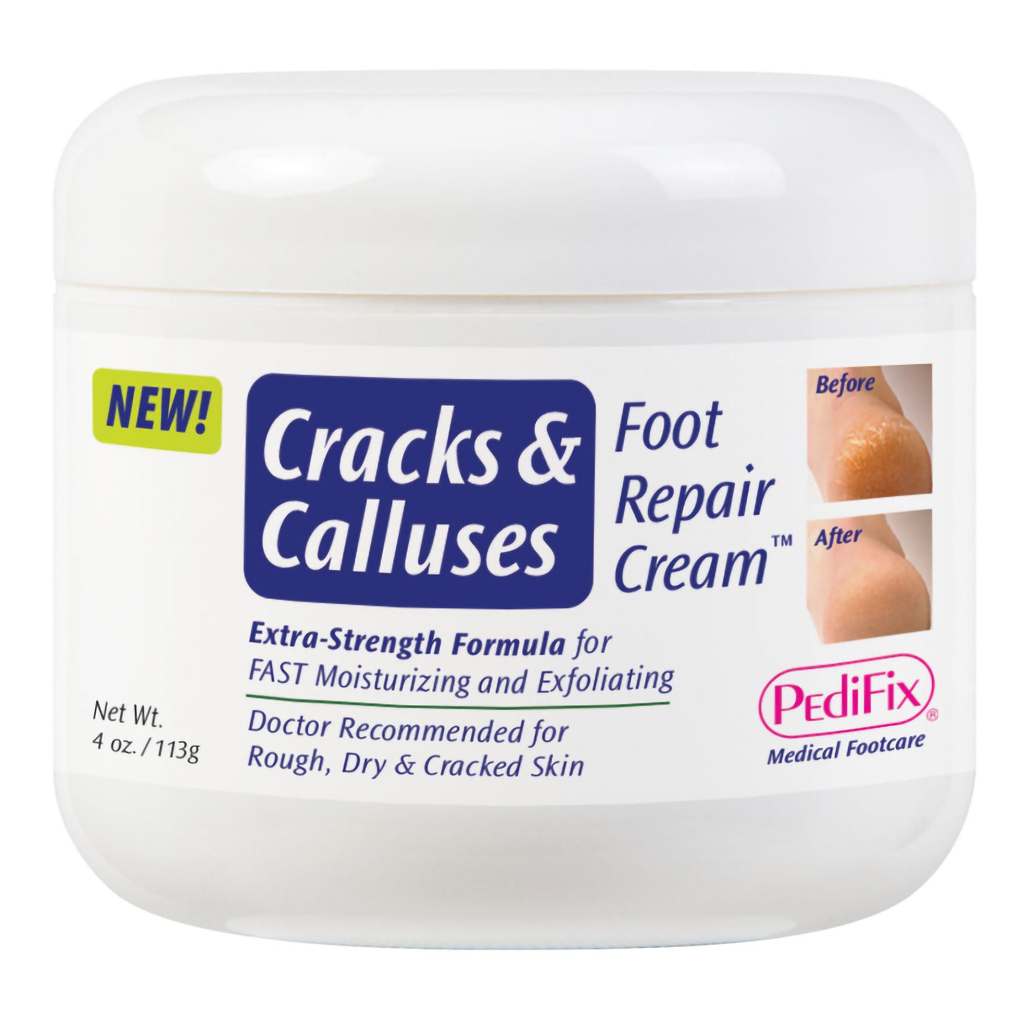 Pedifix - P3305 PediFix® Cracks and Calluses Foot Repair Cream™