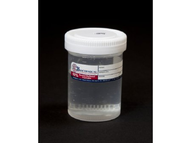 Dynamic Diagnostics - MA0102014 BBC Biochemical Trans-Pak™ Prefilled Formalin Container