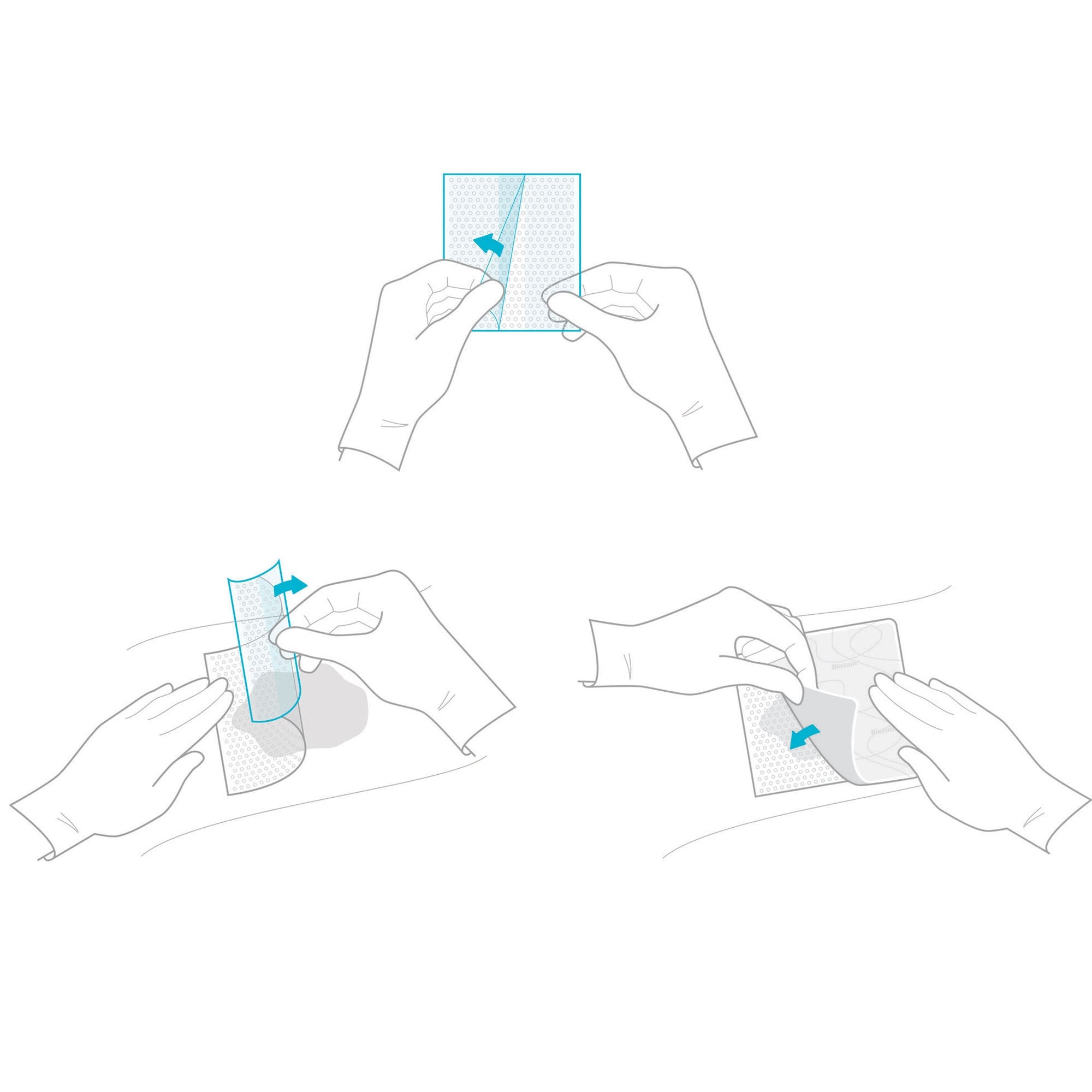 Coloplast - 33563 Wound Contact Layer Dressing Biatain® Contact 6 X 10 Inch Sterile