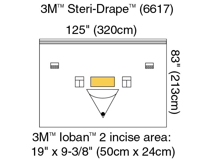 Solventum Corporation 6617 - 3M™ Steri-Drape™ Sterile Orthopedic Drape, 125 x 83 Inch - 1/Each, 5/Box, 20/Case