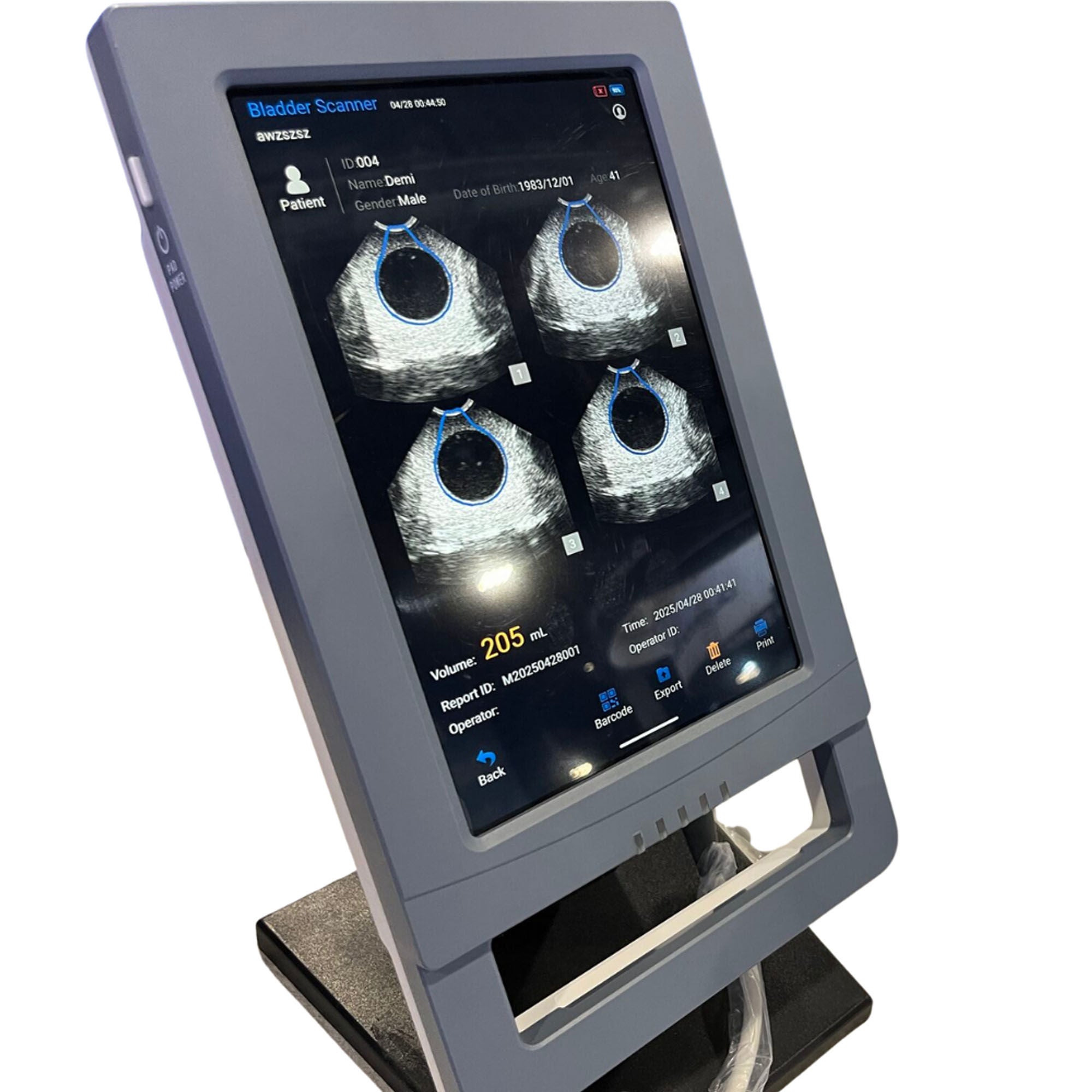 Florida Medical Sales - INF-VIS906 Bladder Scanner VioScan®
