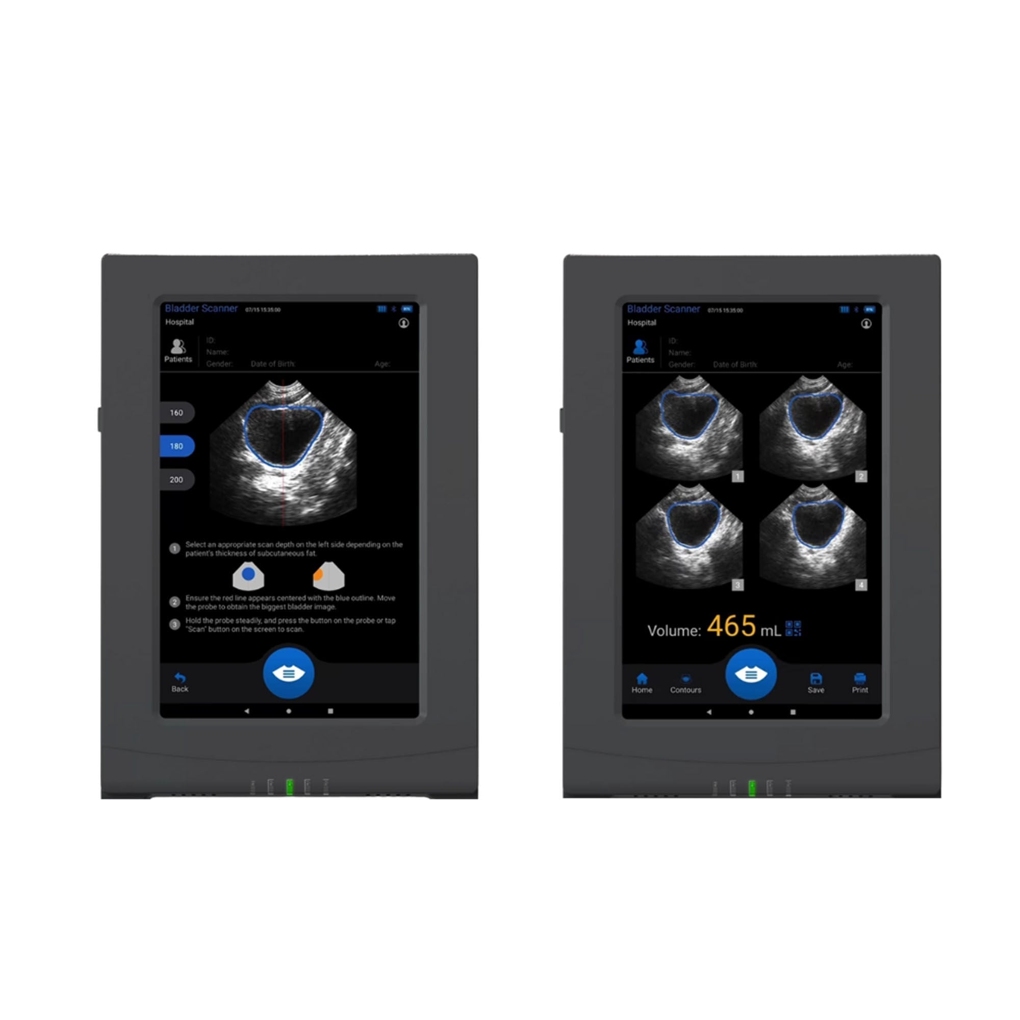 Florida Medical Sales - INF-VIS906 Bladder Scanner VioScan®