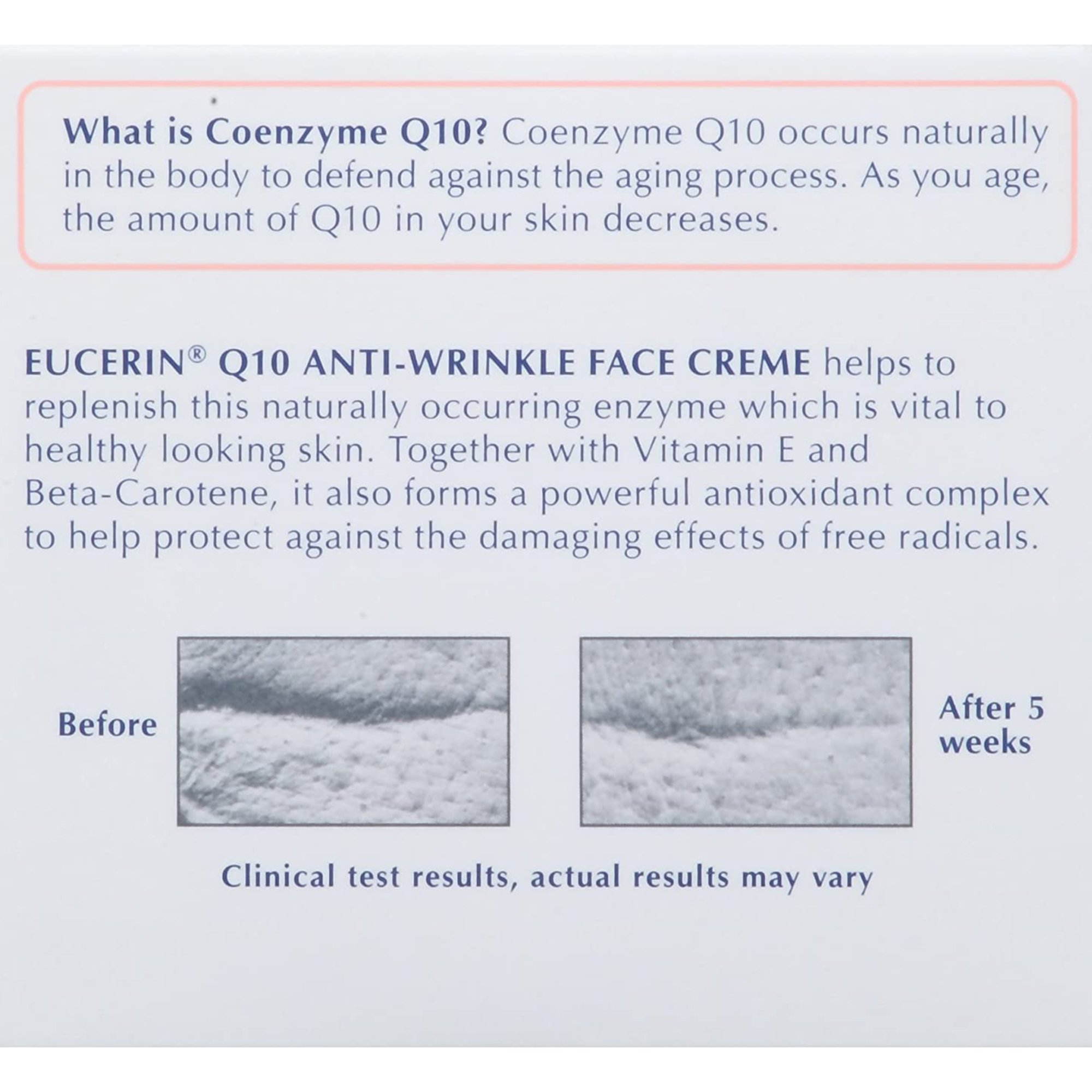 Beiersdorf 07214063413 - Eucerin® Q10 Anti-Wrinkle Sensitive Skin Face Cream, 1.7 oz. - 1/Each