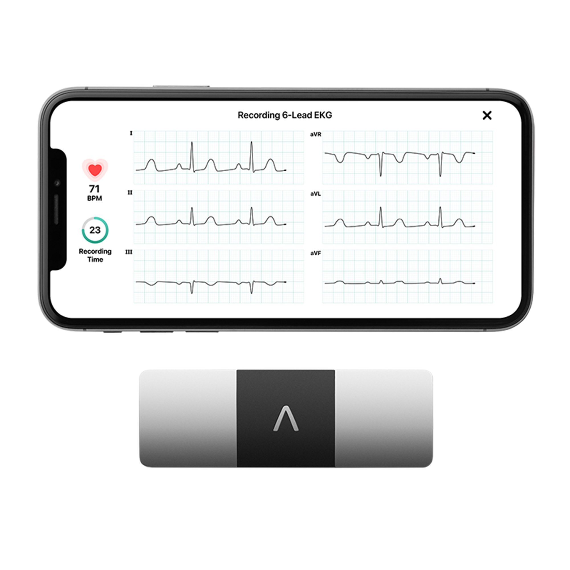 AliveCor Inc AC-019-NUA-A - KardiaMobile® 6L Electrocardiograph - 1/Pack, 24/Case