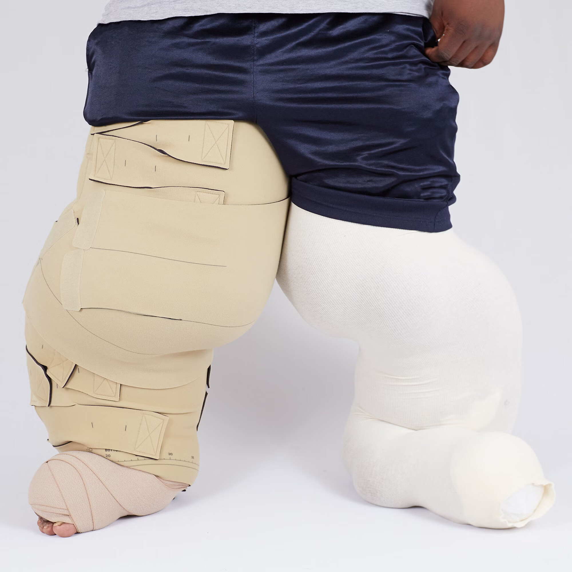 Mediusa - CRA7S001 Reduction Kit circaid® One Size Fits Most Beige Upper / Lower Leg / Lobe
