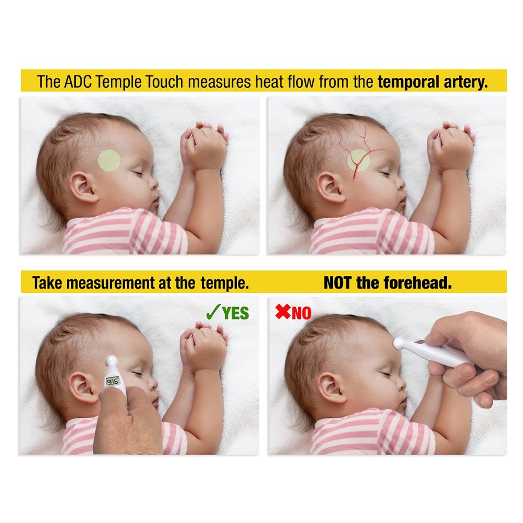American Diagnostic Corp 427 - ADC AdTemp 427 TempleTouch Digital Temporal Thermometer - 1/Each, 12/Pack
