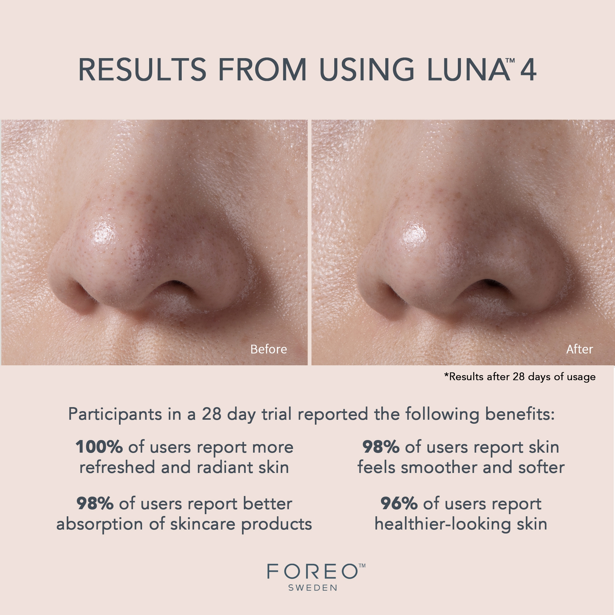 Foreo Inc F1269 - LUNA™ 4 Facial Cleansing Device for Balanced Skin - 1/Each
