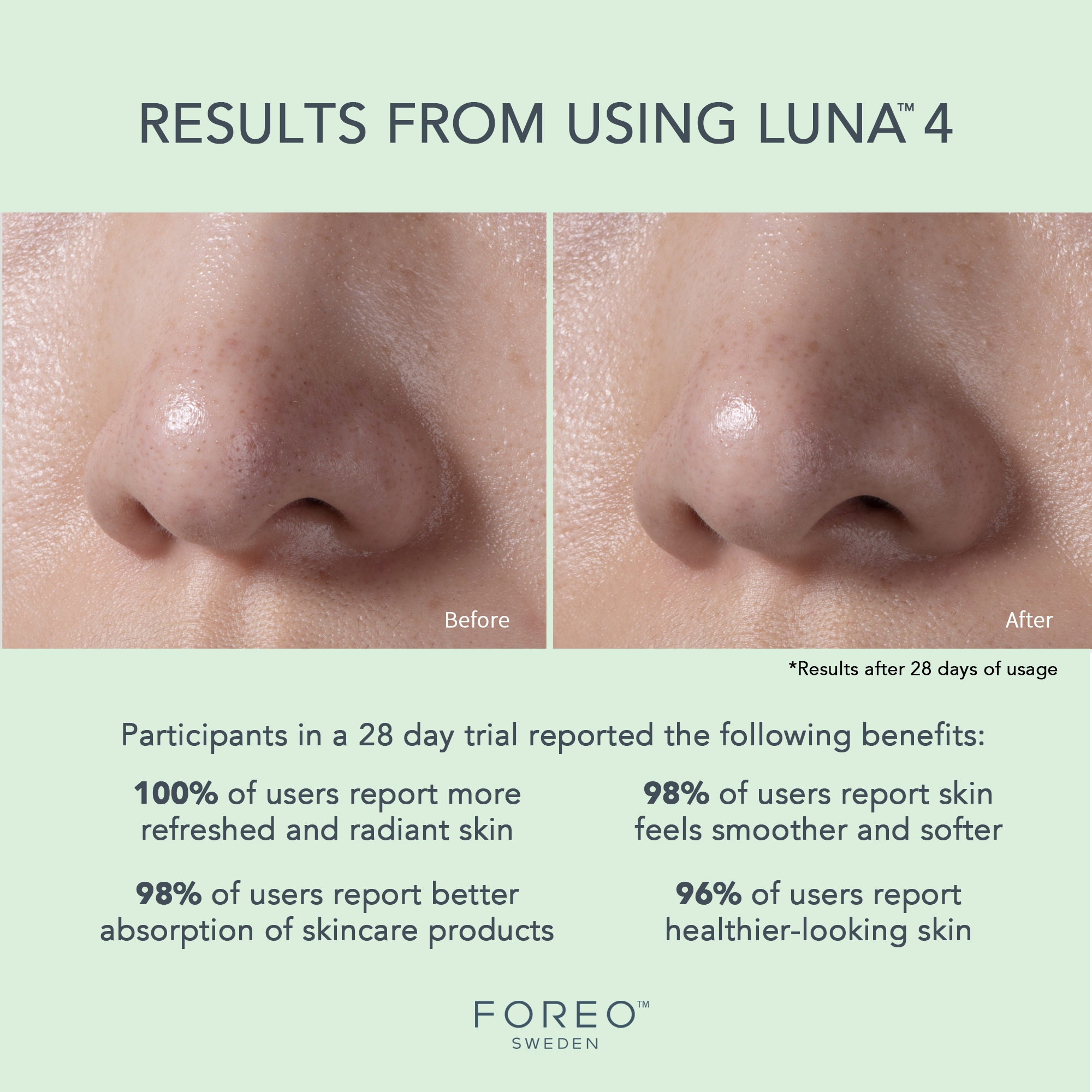 Foreo Inc F1276 - LUNA™ 4 Facial Cleansing Device for Combination Skin - 1/Each