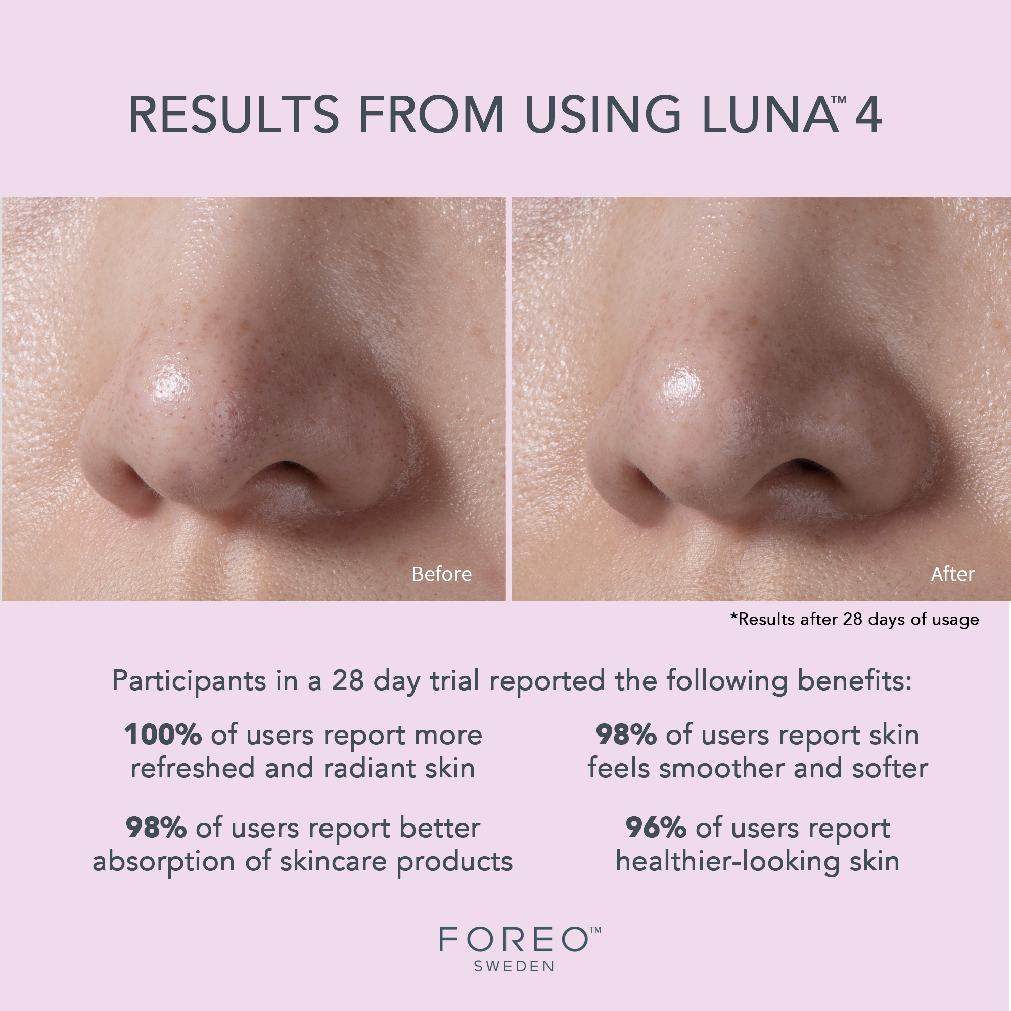 Foreo Inc F1252 - LUNA™ 4 Facial Cleansing Device for Sensitive Skin - 1/Each