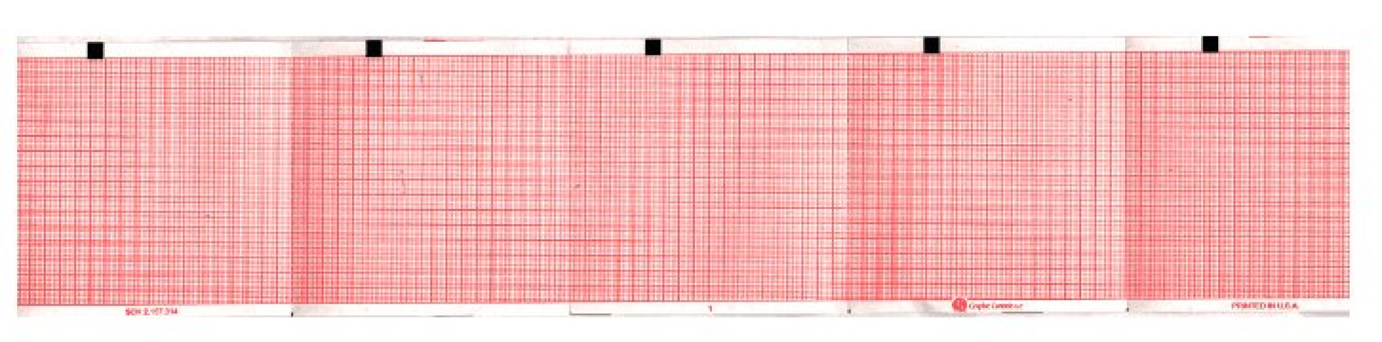 Schiller Recording Chart Paper 7G32016929 by Nissha Medical Tech
