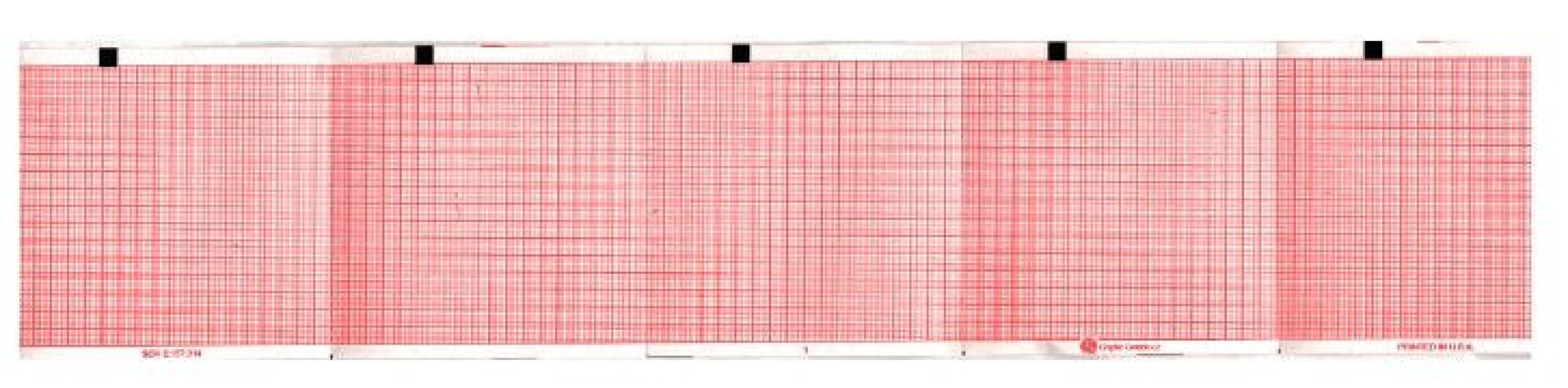 Nissha Medical Tech - 7G32016929 Recording Chart Paper Schiller™ Z-Fold Red Grid