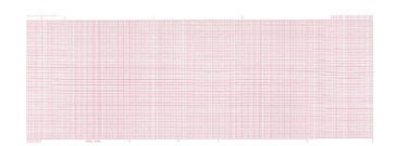 Nissha Medical Tech - 7G01248749 Recording Chart Paper Marquette™ Roll Red Grid