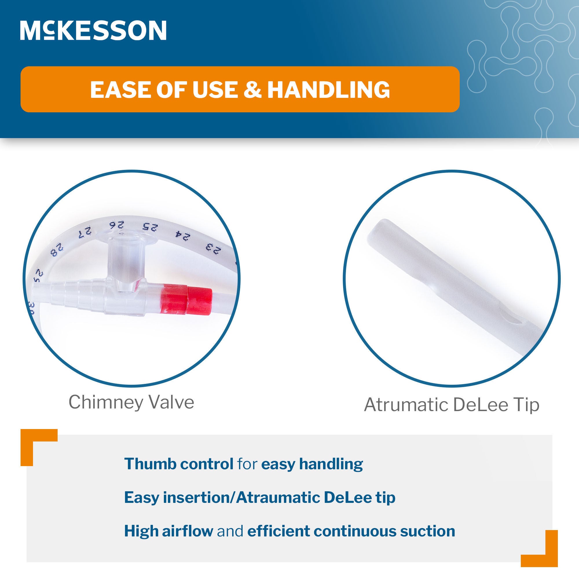 McKesson Brand - 16-DT18FRKR Suction Catheter Tray McKesson 18 Fr. DeLee Tip Chimney Control Vent