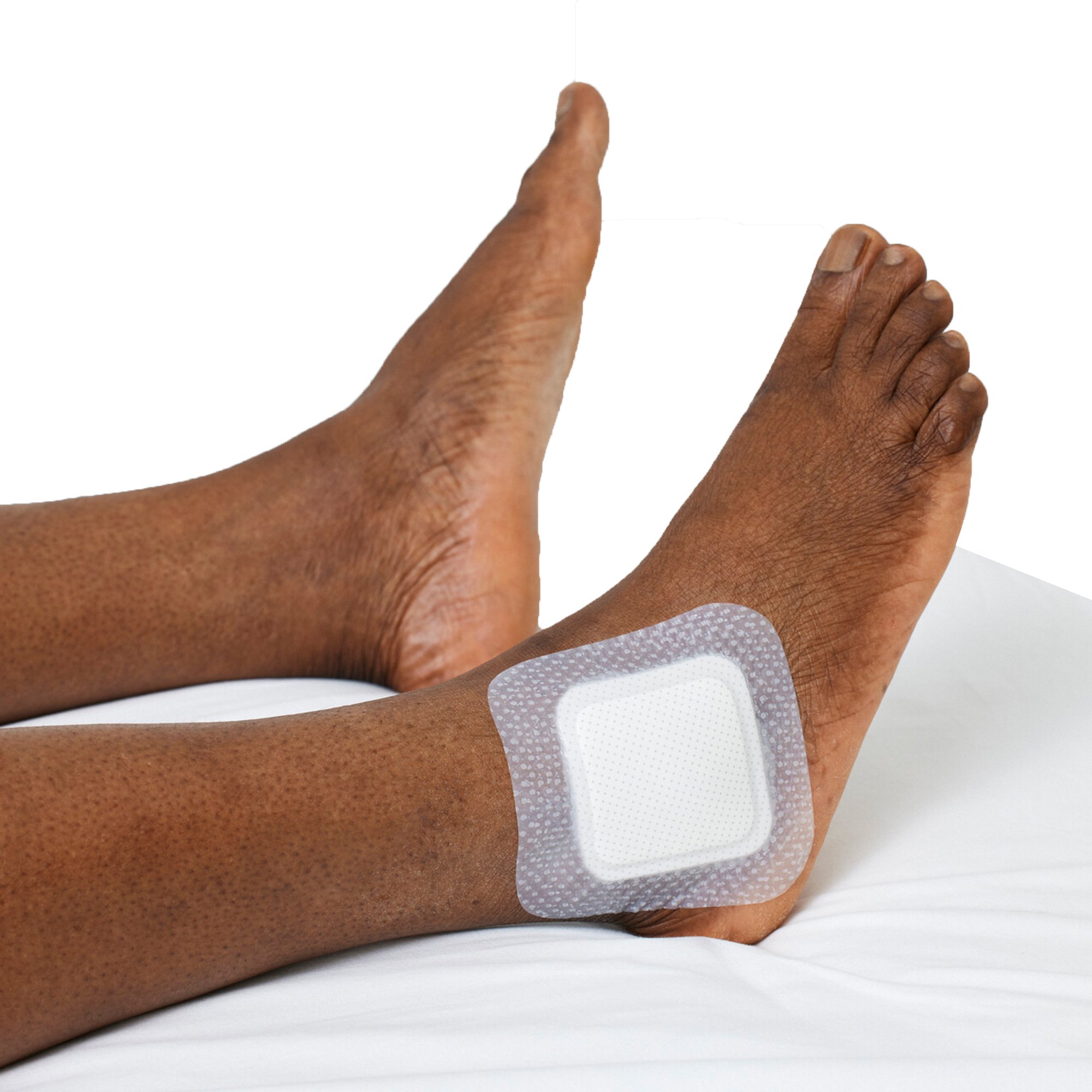 Biatain Silicone Fit Foam Dressing 37539 by Coloplast