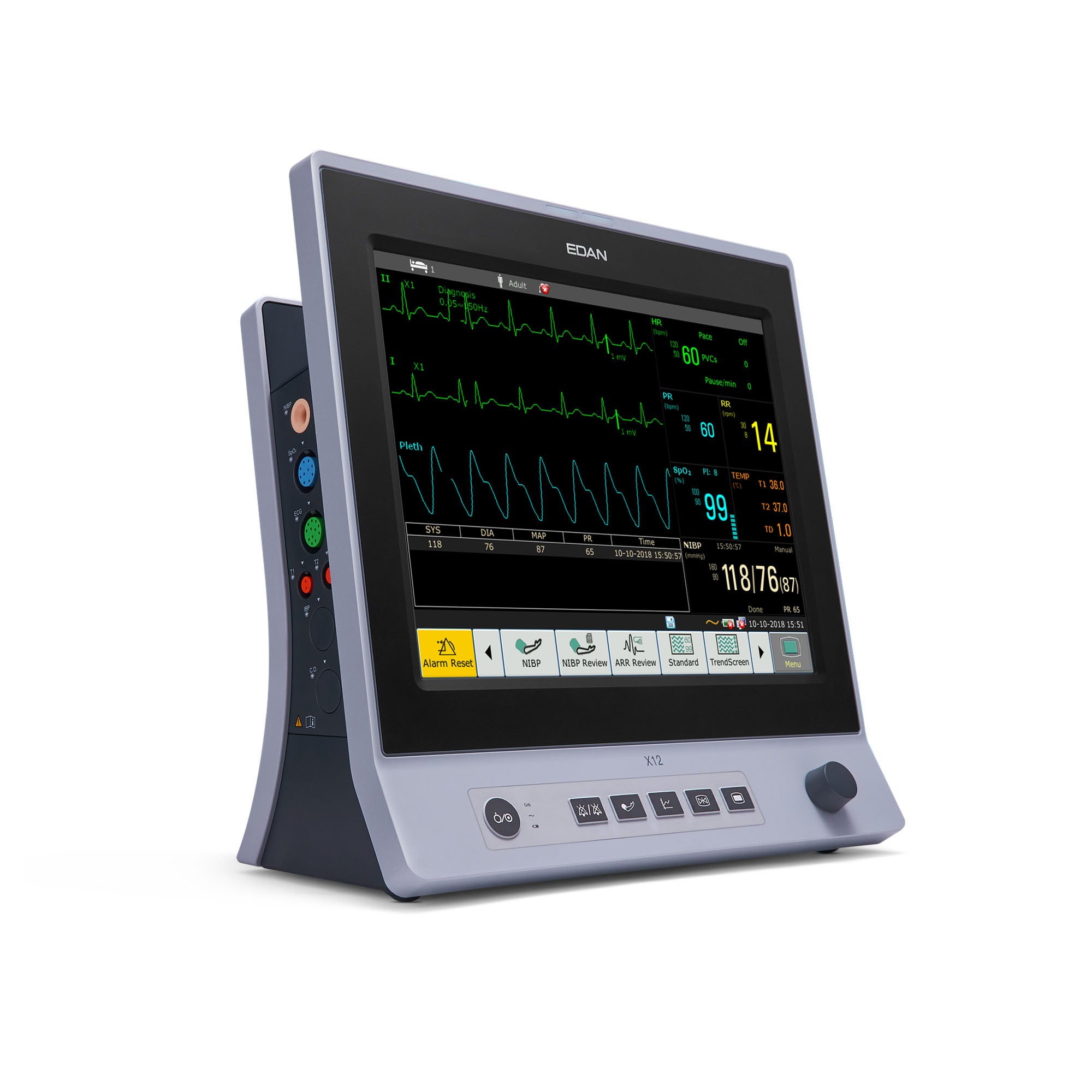 EdanUSA & MDPro - X12-G2 Patient Monitor with Co2 Edan®X12 Series Monitoring 3/5 lead ECG, G2 CO2, NIBP, SpO2, Temp Ac Power