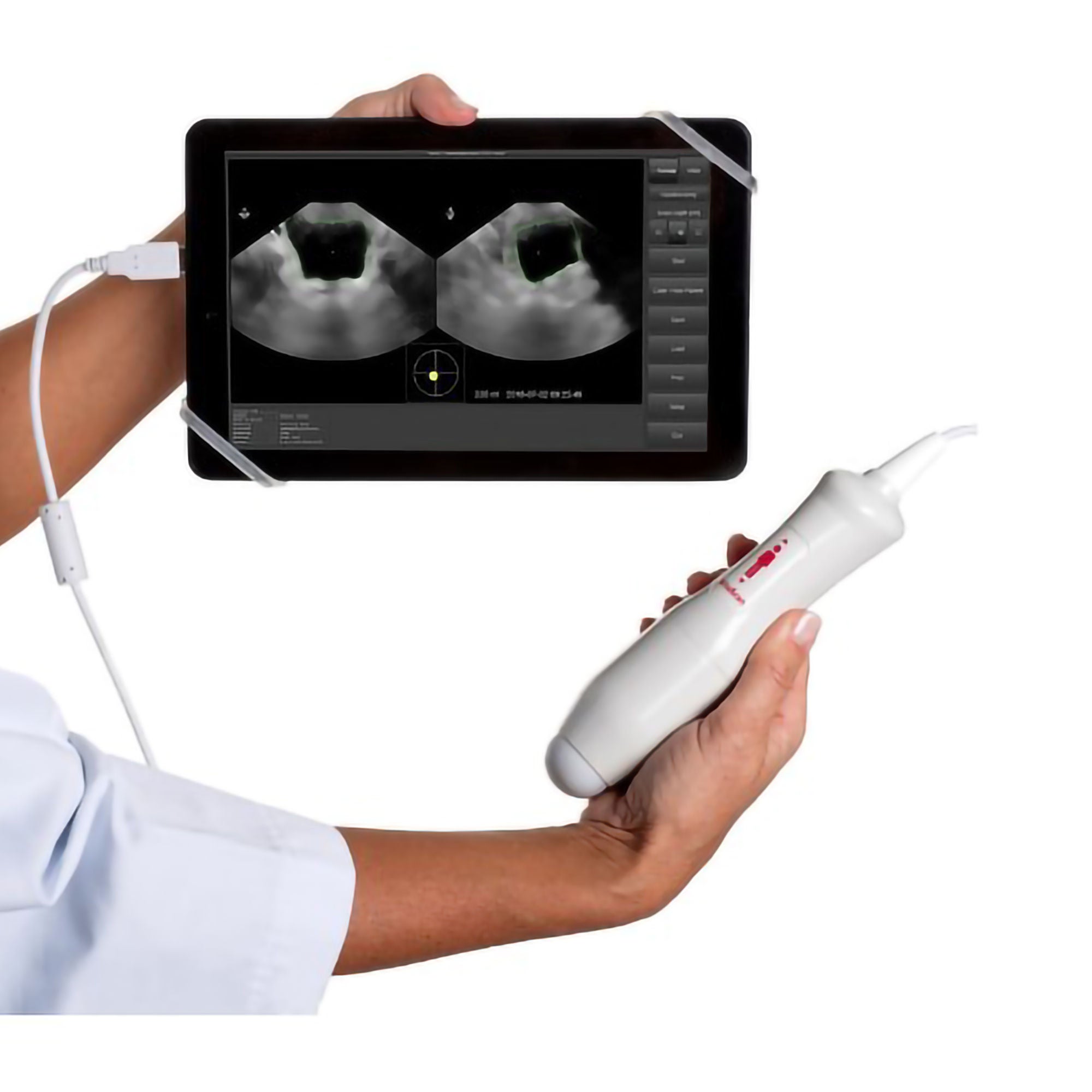 Vitacon - 100525EVUE Bladder Scanner VitaScan LT