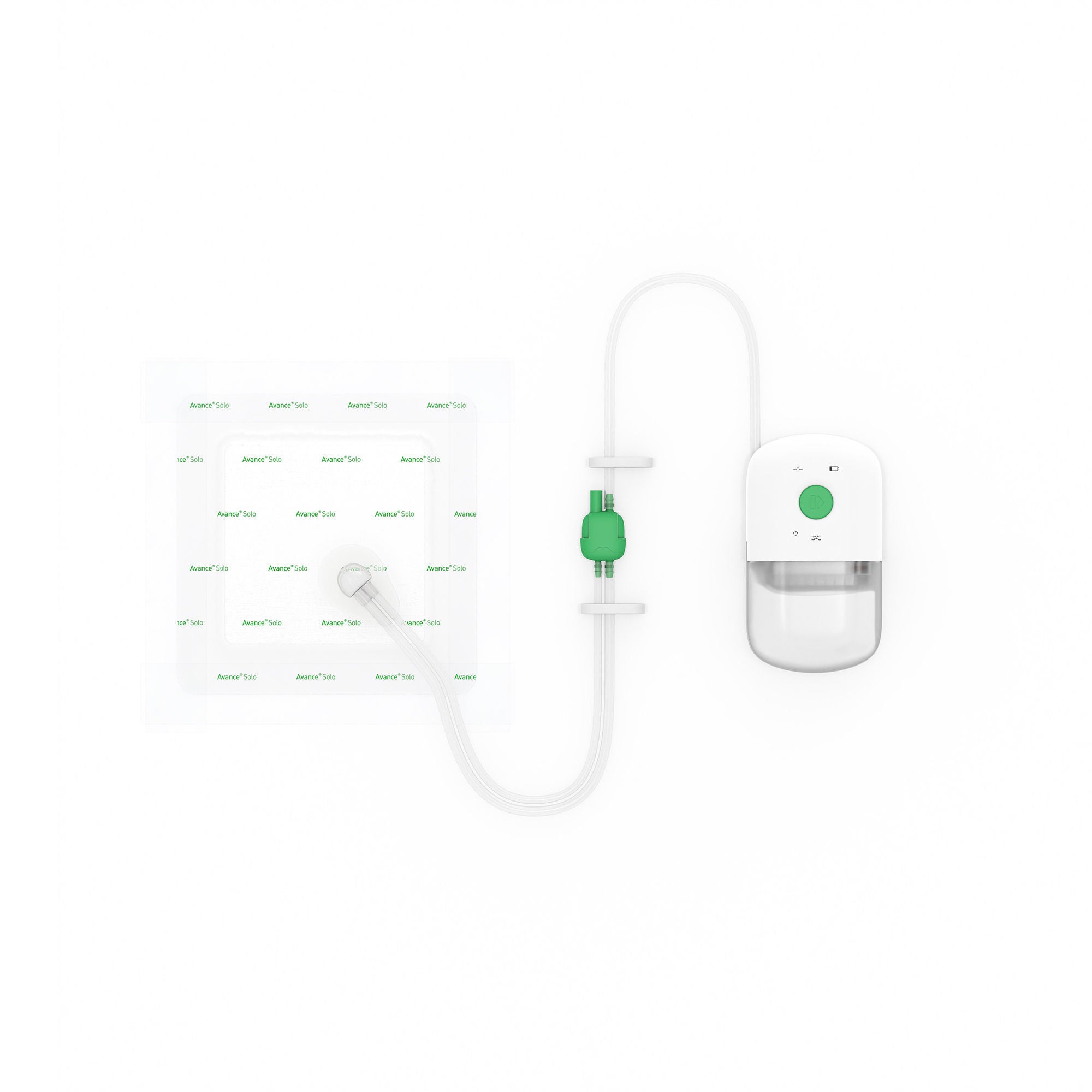 Molnlycke - 8881035 Negative Pressure Incision Care Kit Avance® Solo -125 mmHg 10 X 35 cm