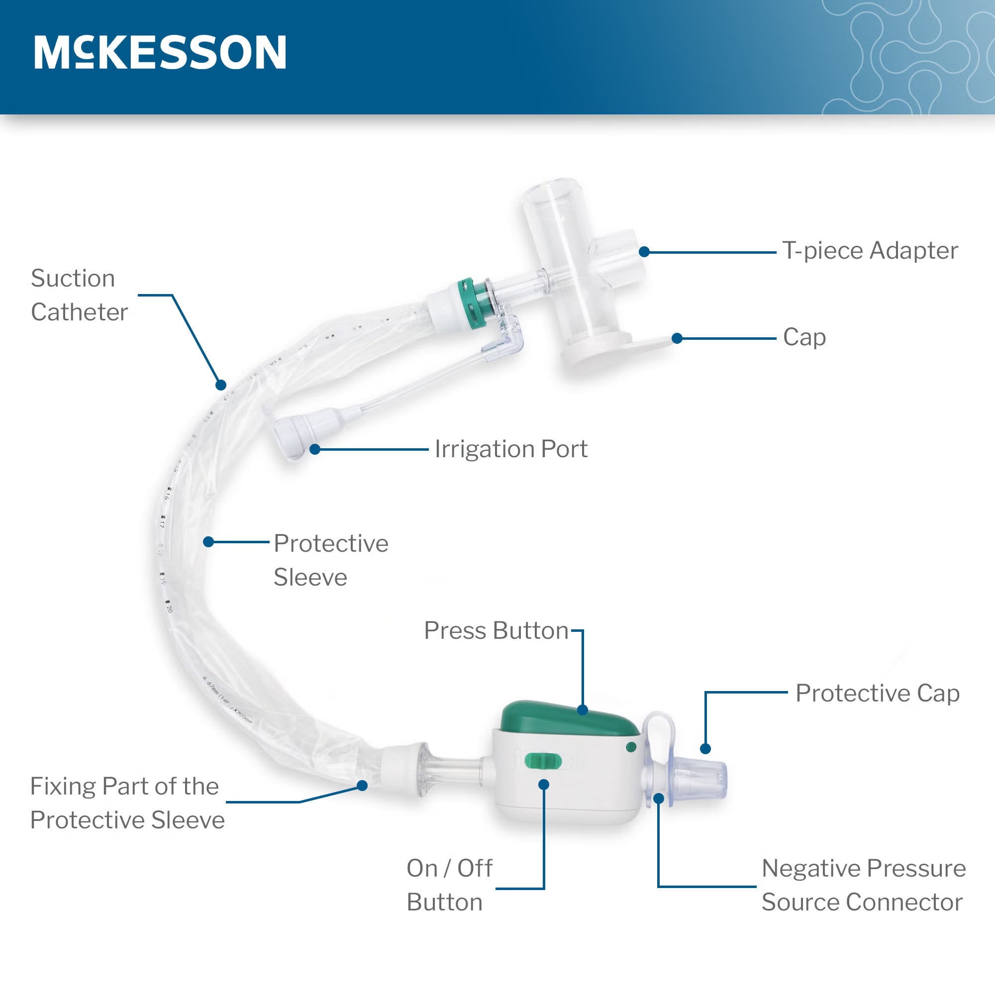 McKesson Brand - 16-TR14FR Closed Suction Catheter McKesson Tracheostomy Type Atraumatic Tip T-Piece Style Thumb Valve Vent 14 Fr. Sterile