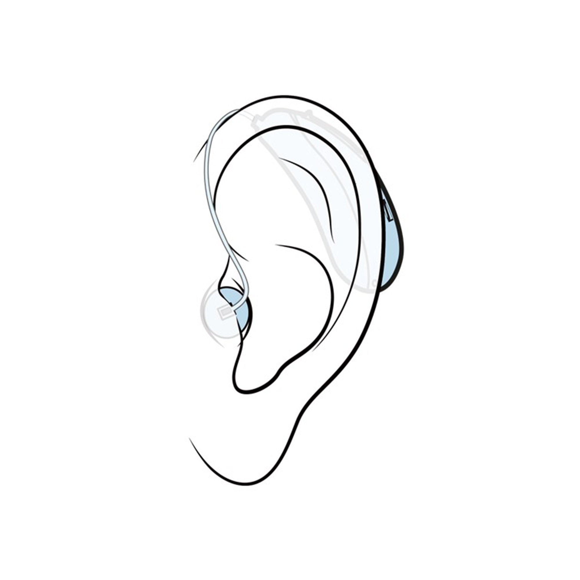 Sonova Consumer Hearing USA LLC 051-5046-AB - Sennheiser All-Day Clear OTC Hearing Aid, Silver/Black - 1/Box, 6/Case