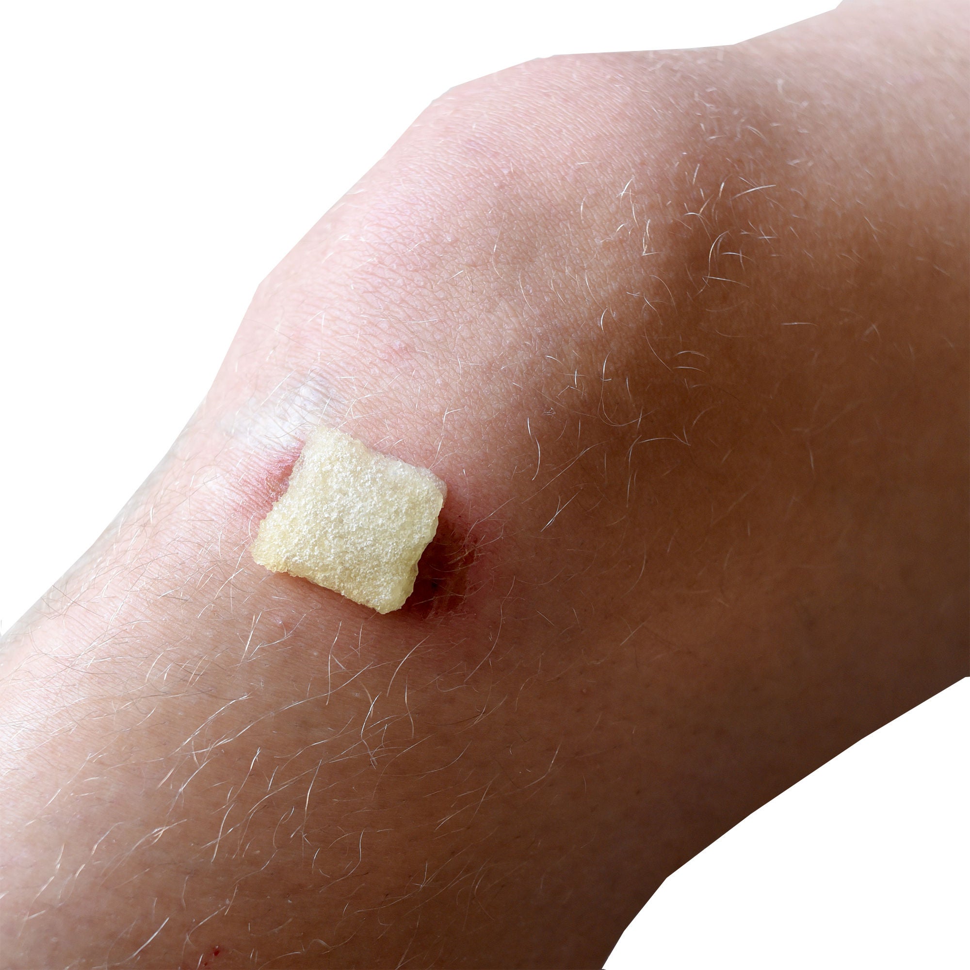 SweetBio Inc - VERIS-25X25-MP15 Honey Wound Dressing VERIS™ Square 1 X 1 Inch Sheet Sterile Without Adhesive