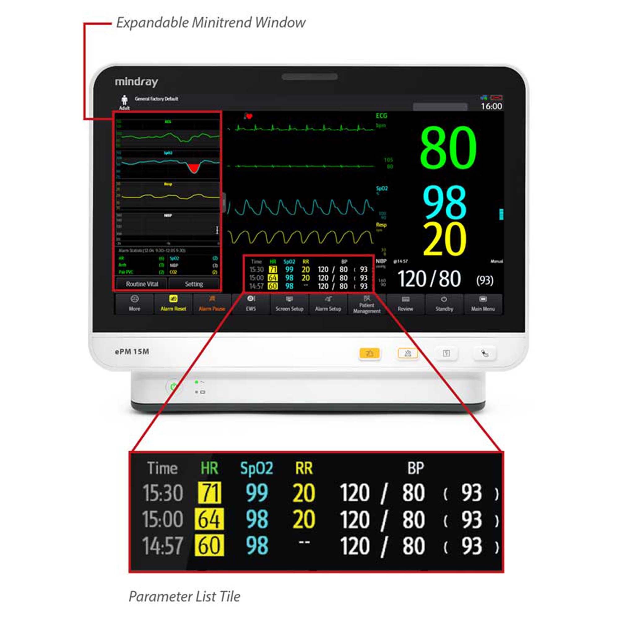Mindray USA - 121-002712-00 Patient Monitor Mindray ePM Monitoring 3 / 5 Lead ECG / NIBP / Repiration / SpO2 / Temperature AC Power / Battery Operated
