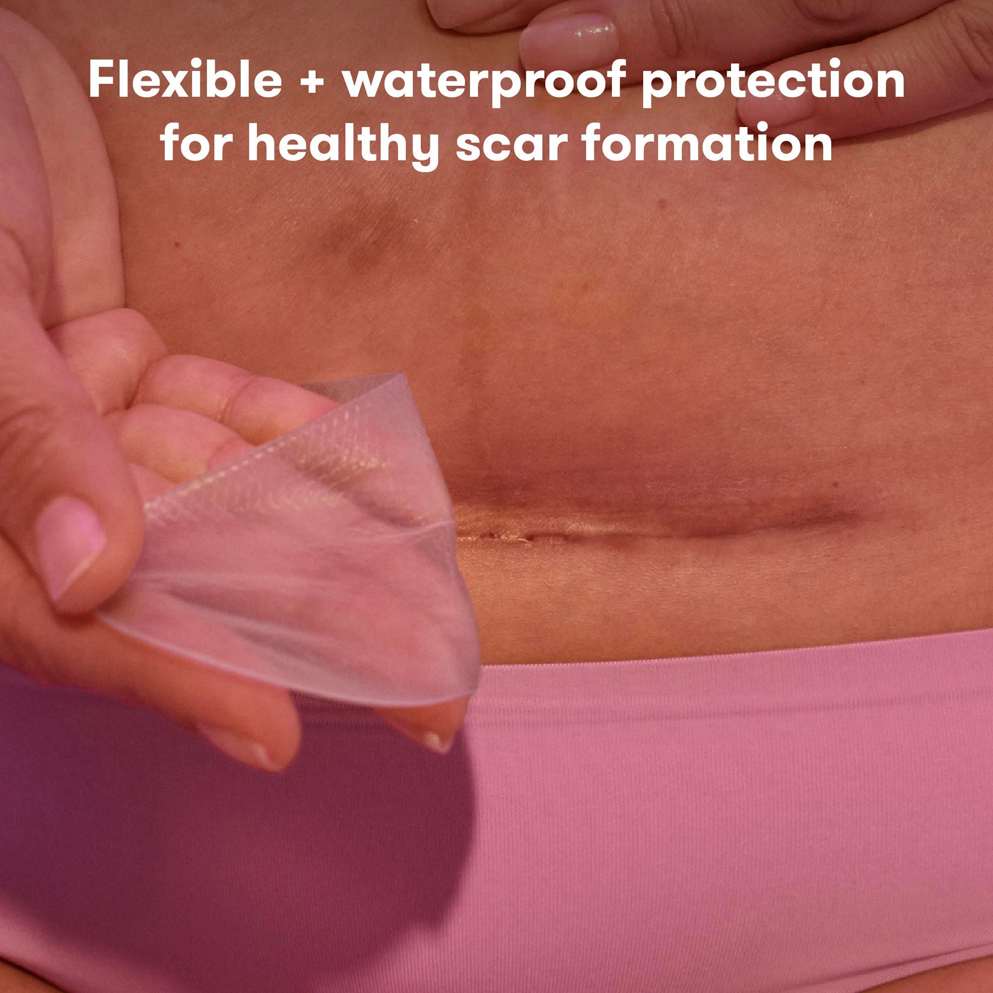 Fridababy LLC - 500001330 Silicone Skin Strip frida mom C-Section 8 Inch Length Rectangle NonSterile