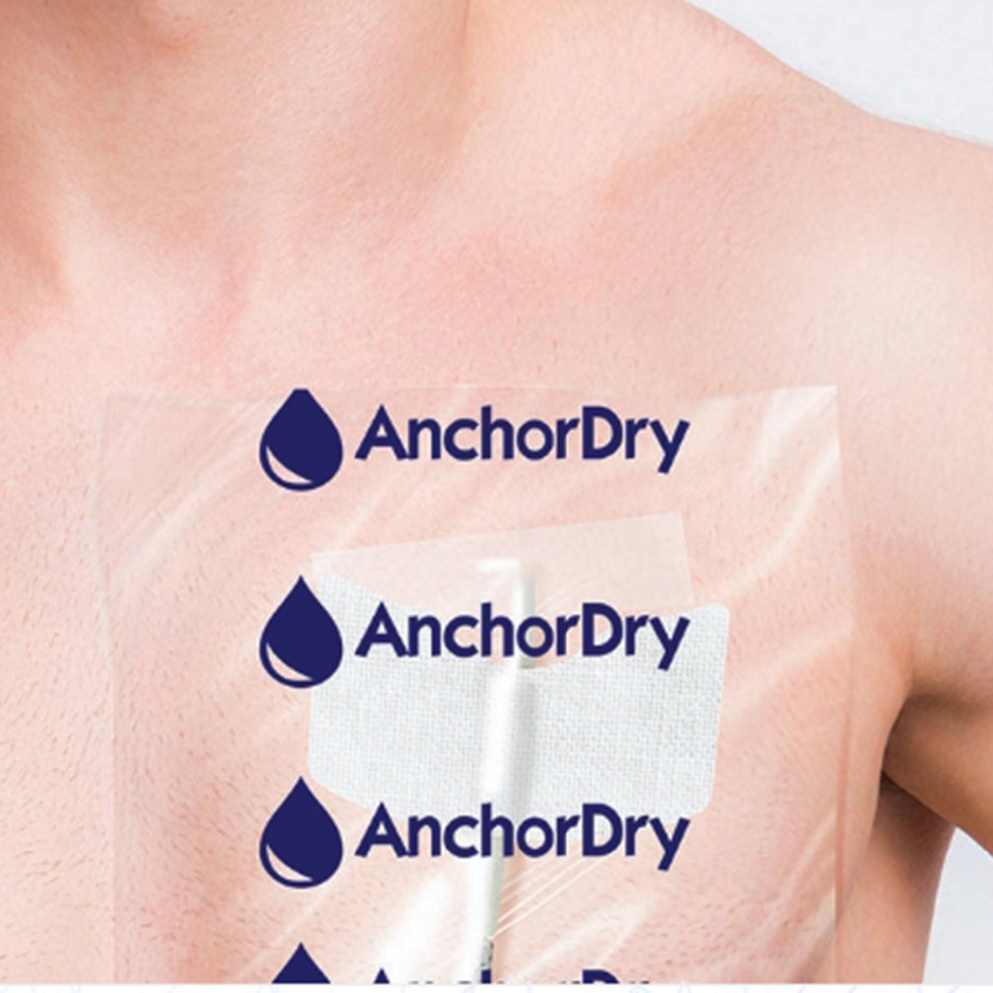 iMed Technology Inc - IMED 10X12 IV Site Barrier Protector AnchorDry™ 10 X 12 Inch Rectangle NonSterile