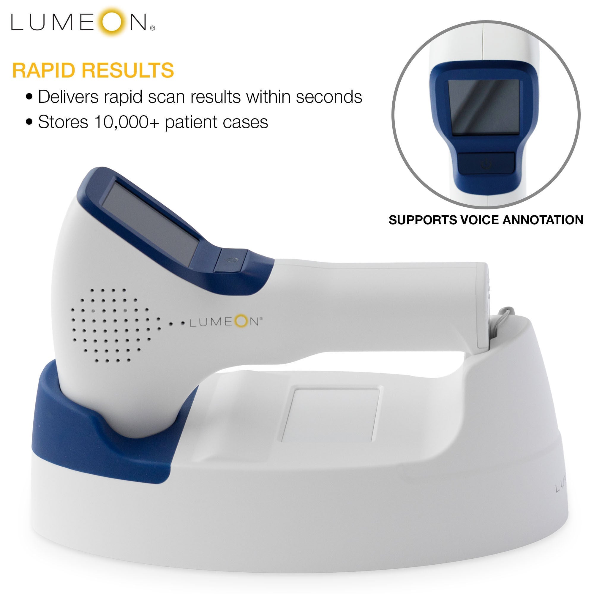 McKesson Brand - 259-M2 Bladder Scanner McKesson LUMEON™