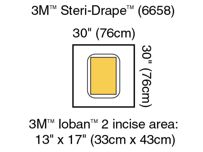 Solventum Corporation 6658 - 3M™ Steri-Drape™ Sterile Large Pouch Surgical Drape, 30 x 30 Inch - 5/Box, 20/Case