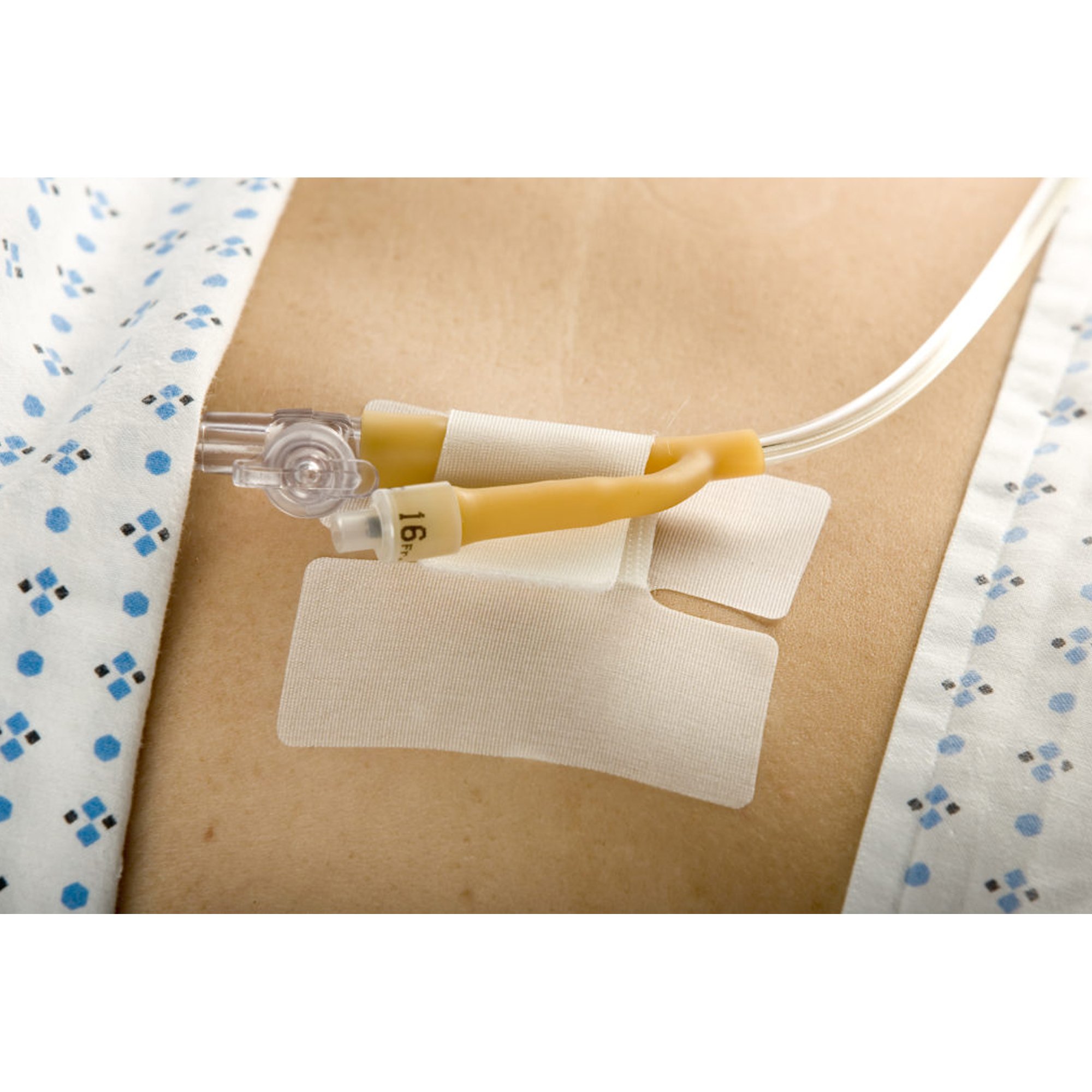 M.C. Johnson 5445-2 - Cath-Secure™ Holder, Tube - 1/Each, 50/Box